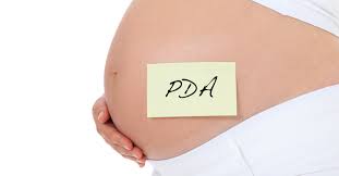 Download schwangerschaft and enjoy it on your iphone, ipad, and ipod touch. Wann Kann Eine Pda Bei Der Geburt Angewendet Werden Schwangerschaft At