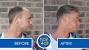 White Balding Man Weave