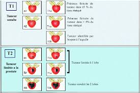 Prostate cancer is the most often diagnosed cancer in canadian men, aside from skin cancers. La Classification Tnm Des Cancers De La Prostate