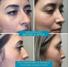 Profile for Michigan Cosmetic Surgery: Mariam Awada, MD FACS