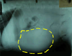 Spleen tumor in dogs is a type of metastatic cancer that is highly dangerous and with poor survival rates, most commonly seen in certain dog breeds. Hemangiosarcoma Is Blood Or Skin Cancer In Dogs And Cats Veterinary Partner Vin