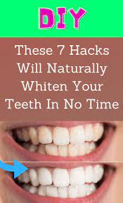 7 Simple Hacks To Naturally Whiten Your Teeth Fast Diy Natural Products Diy Cream Diy Life Hacks