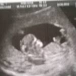 Dans le cadre du régime de la séparation des biens, les biens acquis personnellement par chaque partenaire avant et en cours il ne nécessite pas l'accord de l'autre partenaire pour la gestion de ses biens propres. Intervention Sur Le Volant Le Jour J Permis De Conduire Forum Vie Pratique Doctissimo