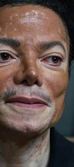 Down Syndrome Guitarist Michael Jackson