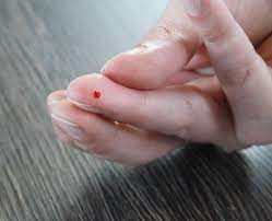 Vitamine D Bloedtest Health Stories