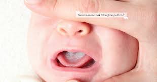 Bagian wajah yang sering ditumbuhi bintik putih milia meliputi hidung, pipi, dahi dan di sekitar mata. Penting Ibu Bapa Kena Tahu Punca Tompokan Putih Di Lidah Bayi Jangan Sudah Terlewat Baru Menyesal Nona