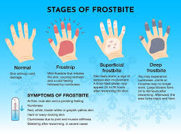 Windchill Warning & Precautions — POND HOCKEY CLASSIC