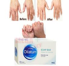 Soothes conditions such as eczema and dermatitis and locks in. Oilatum Soap Bar Stiefel For Dry Skin Gently Cleanses Moisturises Protects 100g Ebay