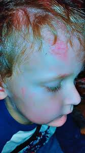 Hot pocket throwing incident at school