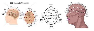 Qeeg Assessment And Brain Mapping At Edmonton Neurotherapy