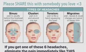Sinus Headache Location Chart Sinusitis