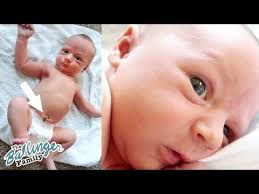 How to change baby's diaper to change your newborn's diaper, make sure you have all supplies on hand. Umbilical Cord Not Falling Off 03 Cord Blood