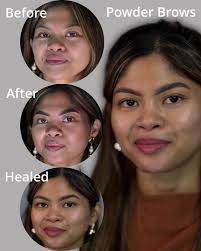 A reminder for all of our new members, this is a non-commercial site,  meaning products and services can not be advertised. Individuals who wish  to share treatments need to include the educational