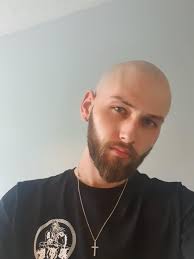 Hair loss is not usually anything to be worried about, but occasionally it can be a sign of a medical condition. Always Been Self Conscious About Hair Loss And At Age 24 I Decided It Was Time For It To Go Anyone Else Struggling With The Stress Of Male Pattern Baldness Before Your