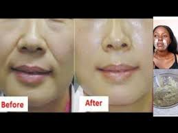 Can you get rid of smile and laugh lines? How To Get Rid Of Smile Lines Remove Laugh Lines Instantly Ogo Beauty Youtube