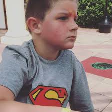 Stevens Soldiers Fight For Epilepsy Awareness