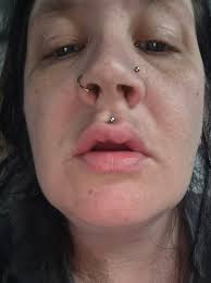 Amanda Bynes shares a rare selfie after having lip filler with the caption  "Minor infection but swelling has finally gone down" thoughts 🤔💄