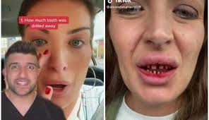 IŠLA SAM U TURSKU PO HOLIVUDSKI OSMEH, A VRATILA SAM SE KAO NAKAZA!  Potresna ispovest britanske