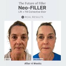 Check out Jeanie's NeoFiller results and testimony: 👇 “I never in my  wildest dreams would've thought something that you apply to your skin can  plump and fill itself and in a matter
