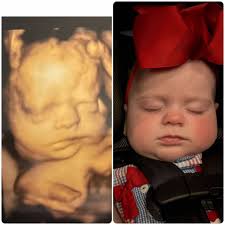 Those cheeks 🥰🥰😍😍 welcome to the world baby girl!