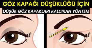 Goz Kapagi Dusuklugu Goz Kapagindaki Sarkmalara Bilgi Doktoru Movie Posters Anti Aging Health
