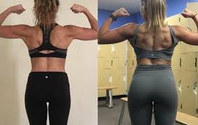 how i went from scoliosis surgery to