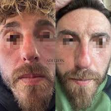 Adi Leon Skin care & MakeUp