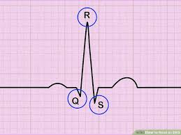 How To Read An Ekg An Interpretation Guide With Sample