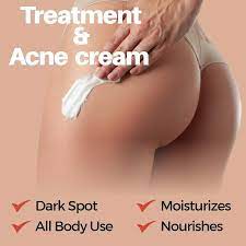 Beauty & Divine Butt Premium Treatment & Acne Cream | eBay