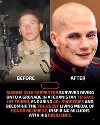 Kyle Carpenter says he never went a day at the University of South Carolina  without a professor or fellow student thanking him for his sacrifice as a  Marine.