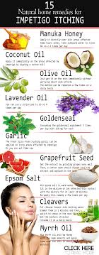 Home Remedies For Impetigo Itching Epsom Salt Manuka Honey Aloe Vera White Vinegar Garlic Heat Therapy Tea Tree Oil Home Remedies Remedies Melaleuca Oil