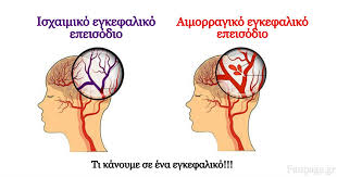 Check spelling or type a new query. Ti Kanoyme Se Periptwsh Egkefalikoy Energhste Grhgora Isxaimiko Kai Aimorragiko Aggeiako Egkefaliko Epeisodio Fanpage