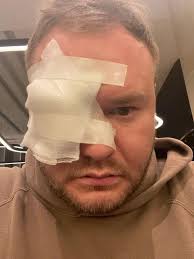 Adult Hockey Player's Eye 'Basically Exploded' After 1 Shocking Play  (Exclusive)