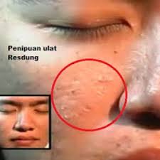 Download lagu buang ulat resdung (2.7mb) dan streaming kumpulan lagu buang ulat resdung (2.7mb) mp3 terbaru di hasil diatas adalah hasil pencarian dari anda buang ulat resdung mp3 dan menurut kami yang paling cocok adalah buang ulat resdung. Ulat Resdung