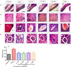 Image result for Xeroderris stuhlmannii