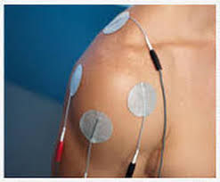 Image result for Electrical Stimulation Therapy