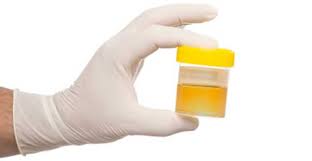 De Kleur En Geur Van Urine Op Het Keto Dieet Confetissimo Vrouwenblog