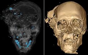 Pin On Radiology