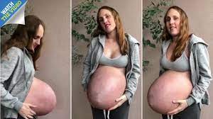 Bullies Told Me My Pregnancy Bump Was Gross And Said It Was So Big I Must Be Expecting A Horse