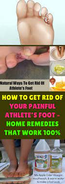 Trichophyton Fungus Is The Common Cause Of The Fungal Infection Known As Athlete S Foot This Is A Co Athletes Foot Remedies Foot Remedies Foot Fungus Remedies