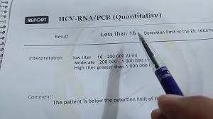 You've been in contact getting a pcr test for someone else. Ù‚Ø±Ø§Ø¡Ø© ÙˆØªÙØ³ÙŠØ± Ù†ØªÙŠØ¬Ø© ØªØ­Ù„ÙŠÙ„ Pcr Ù„ÙÙŠØ±ÙˆØ³Ø§Øª Ø§Ù„ÙƒØ¨Ø¯ Youtube