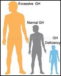 In most people, growth hormone deficiency is caused by a benign tumor on the pituitary gland (pituitary adenoma) or by treatment of an adenoma with surgery or radiotherapy. Growth Hormone Deficiency Biology For Everybody