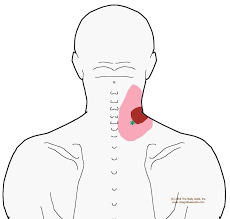 Pin On Pain Relief