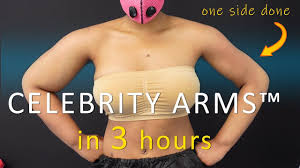 Arm Liposuction Immediate Results Celebrity Arms Lipo 360 Arms Hi Arm Liposuction Liposuction Celebrity Arms