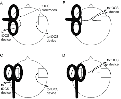 example tms coil orientations and tdcs lead configurations