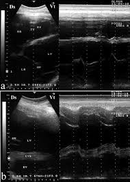 This includes determination of continuous personal growth and willingness to effectively learn and use new information for personal, family and career growth. Echocardiography Of The Normal Camel Camelus Dromedaries Heart Technique And Cardiac Dimensions Bmc Veterinary Research Full Text