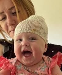 Kyiv neurosurgeons saved a 5-month-old girl after the Russian night attack 