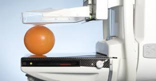 Wann sollte die mammographie erfolgen? Mammographie Screening