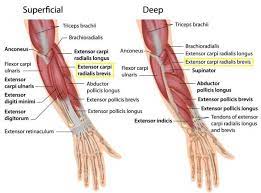 The term forearm is used in anatomy to distinguish it from the arm. Tennis Elbow What Is It Do You Have It And How Do You Treat It Forearm Muscles Muscle Anatomy Tennis Elbow