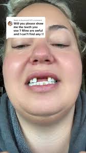 Hope this helps whether you have missing teeth or just discolouration or  crooked teeth they can usually help! ❤️ @Brighter Image Lab LASHES20 to  save 💰#teeth #clipinveneers #cliponveneers ...